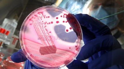 is e coli a bacteria